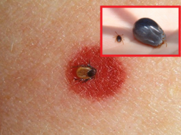 Lauksaimnieks negaidīti atstāja šo pasauli neilgi pēc ērces piesūkšanās. Cilvēki bija asarās, uzzinot ārstu pateikto!