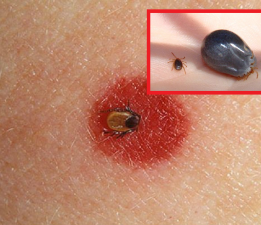 Lauksaimnieks negaidīti atstāja šo pasauli neilgi pēc ērces piesūkšanās. Cilvēki bija asarās, uzzinot ārstu pateikto!