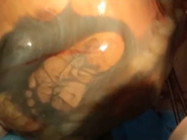 Mamma vien 41. grūtniecības nedēļā pirmo reizi aizgāja pie ginekologa! Pēc ultrasonogrāfijas ārsti šausmās saķēra galvu!