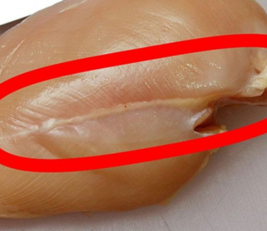 Lūk, kas patiesībā ir šīs baltās līnijas uz vistas filejas! Nekādā gadījumā nepērc tādu gaļu!